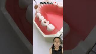 CACING DI GIGI⁉️ dentist teethshield diy healthyteeth satisfying handmade art music anime [upl. by Herzel]