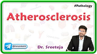 3 Atherosclerosis  Pathology USMLE Step 1 [upl. by Eisaj]