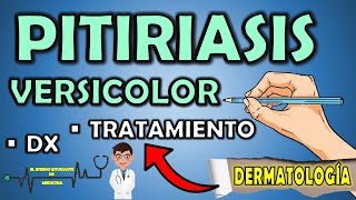 PITIRIASIS VERSICOLOR TRATAMIENTO Y CAUSAS  Diagnóstico  Dermatología  📝👨🏻‍⚕️ EXPLICACIÓN FÁCIL⚡ [upl. by Noiramed]