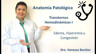 Tusclases  Anatomía Patológica  Trastornos hemodinámicos I  Edema Hiperemia y Congestión [upl. by Lobiv]