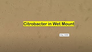 Citrobacter in Wet mount of Culture Microscopy [upl. by Verine82]