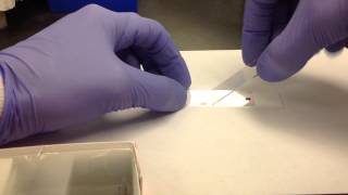 Hematology Making a Peripheral Blood Smear [upl. by Eetak]