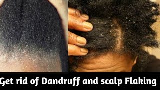 Damatol  Best amp Cheap Treatment For DandruffFlaky Scalp Watch How To Use It [upl. by Zere]