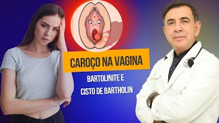 BARTOLINITE DOR E DESCONFORTO NA VAGINA O QUE PODE SER  PREVENÇÃO E TRATAMENTO [upl. by Mingche]