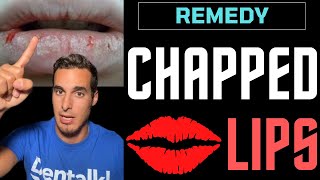 CHAPPED LIPS  Causes and REMEDIES for cracked lips [upl. by Ailimat]