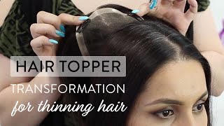 Hair Topper Transformation for Thinning Hair [upl. by Stamata]