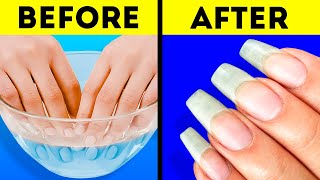 26 AWESOME NAIL HACKS YOU WILL DEFINITELY LIKE [upl. by Eula]