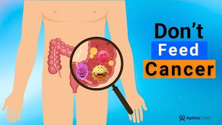 14 Cancer Causing Foods You Should NEVER Eat [upl. by Yejus]