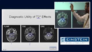 Introducing MRI MR Imaging of Hemorrhage 52 of 56 [upl. by Bondy705]