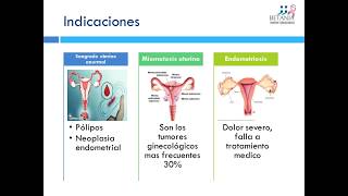 Técnica quirúrgica en Histerectomía abdominal [upl. by Dobbins]