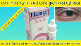 Flomox Eye Drops Bangla চোখে ব্যাকটেরিয়া দ্বারা এবং ভাইরাস দ্বারা বিভিন্ন সংক্রমণ দূর করে Flomox [upl. by Nosyk478]