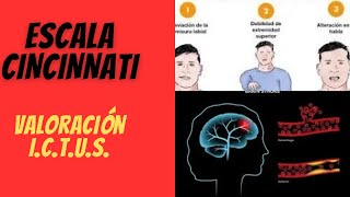 Escala de Cincinnati salva vidas ¿Qué es y cómo funciona [upl. by Dej85]