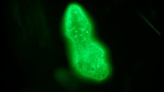 Acridine orange staining for fluorescence  first attempt [upl. by Alocin]