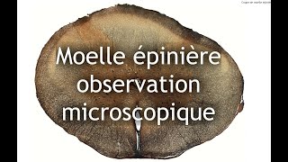 Moelle épinière  observation microscopique commentée [upl. by Braynard]