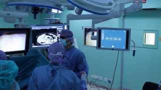 Wearable technology at the OR during laparoscopic surgery using TedCas Myo [upl. by Luwana]