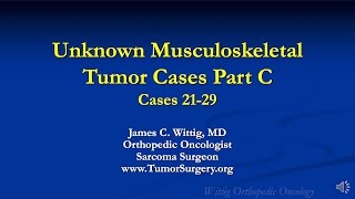 Orthopedic Oncology Course  Unknown Test Cases Part C Cases 2129  Lecture 13 [upl. by Shepherd]