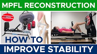 Medial Patellofemoral Ligament Reconstruction  Improving Stability  Part 1 [upl. by Eniowtna304]