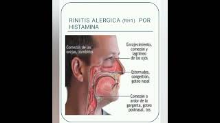 Antihistamínicos Enfermería 2023 [upl. by Llereg]