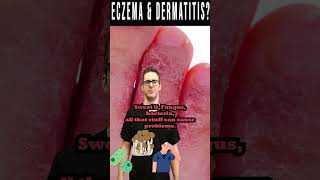 Dermatitis amp Eczema Dry Itchy Skin or Rash not Better [upl. by Aynnek895]