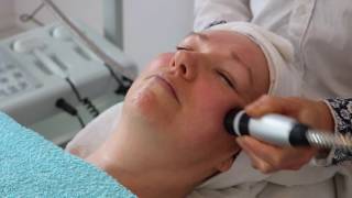 Naaldloze mesotherapie en elasticiteit huid herstellen [upl. by Auqenehs]