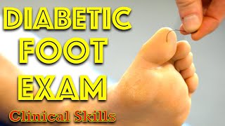 Diabetic Foot Examination  Clinical Skills  Dr Gill [upl. by Myrtie]