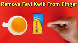 How To Remove Feviquick From Hand Feviquick Remover From Hand [upl. by Gratt]