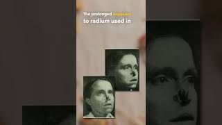 The Terrifying Story Of The Radium Girls shorts mysterious [upl. by Merrie]