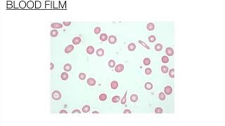 Pharmacology  anaemia [upl. by Eben]