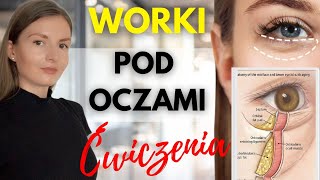 WORKI POD OCZAMI  jak zlikwidować [upl. by Ehrlich]