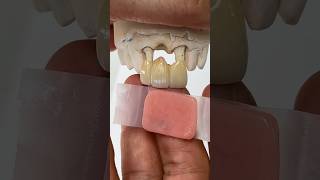 Zirconia Bridge with minimal Pink Porcelain lsk121shorts dental teeth [upl. by Akeem460]