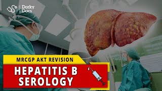 Hepatitis B Serology  MRCGP AKT Revision  Dorky Docs [upl. by Ramraj827]