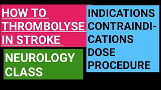 Thrombolysis in acute stroke  indications contraindications dose and procedure [upl. by Eneliak]