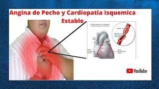 Angina de Pecho y Cardiopatía Isquémica Estable Cap 71 GoldmanCecil [upl. by Novel393]