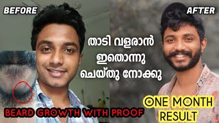 Fast Beard Growth In Months  Beard Growth with Proof🔥 പെട്ടന്ന് തന്നെ താടി വളർന്നു ✌️ [upl. by Rocker]