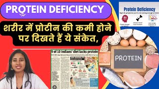 Protein Deficiency प्रोटीन की कमी के लक्षण और दूर करने का उपाय Protein deficiency Signs amp Symptoms [upl. by Ikkin]