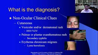 Lecture Uveitis Therapeutics Update [upl. by Vowel]