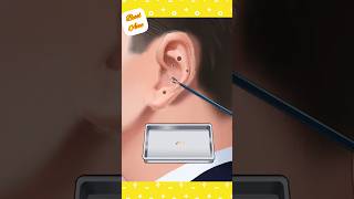 asmr blackhead removal from ear👂🏻removing hairs from ear👂🏻asmrblackheadremovalearshorts [upl. by Terrell]