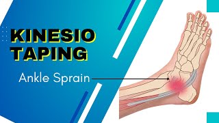 How to Apply kinesiology Tape for an Ankle Inversion Sprain [upl. by Ardiek]