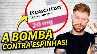 ROACUTAN Minha Experiência com o Tratamento para Espinhas funciona MESMO [upl. by Buckley]