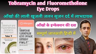 Tobramycin and Fluorometholone ophthalmic suspension uses  Fmlt eye drop  Toba f eye drop [upl. by Haroun219]