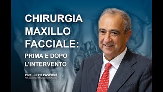 Prima e Dopo lintervento di chirurgia maxillo facciale [upl. by Riegel]