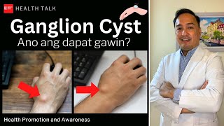 Ganglion Cyst Causes Risk factors Diagnosis Treatment and Prevention [upl. by Korfonta]