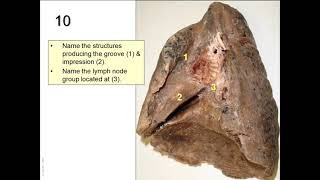 OSPE in anatomy of the respiratory system [upl. by Spielman]