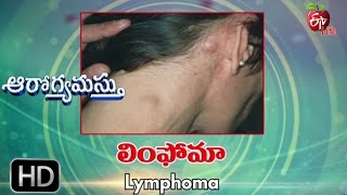 Aarogyamastu  Lymphoma  18th May 2017  ఆరోగ్యమస్తు [upl. by Schlessel227]