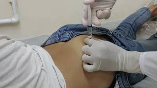 intramuscular injection  im injection [upl. by Leggett944]