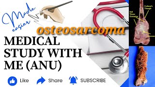 Osteosarcoma pathologymalayalam [upl. by Anedal]