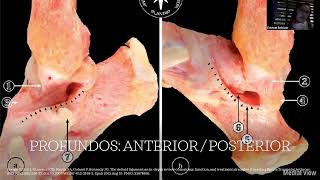 Webinar Lesión de ligamento deltoideo en fracturas de tobillo [upl. by Arded563]