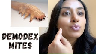 Demodex Mites on the FACE [upl. by Noelle]