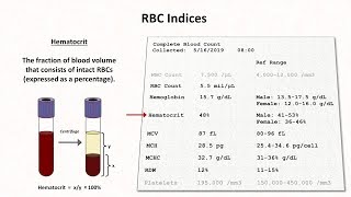 How to Interpret RBC Indices eg hemoglobin vs hematocrit MCV RDW [upl. by Gussi950]