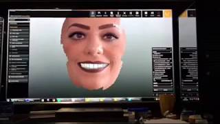 Zirkonzahn FaceHunter  Dentics Cancun [upl. by Mini]